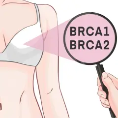 Badanie genów BRCA1 i BRCA2, kluczowych w kontekście mutacji i ryzyka przerzutów raka.