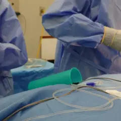 Chirurg przygotowuje się do zabiegu. Warto wiedzieć, jak długo boli pierś po usunięciu guza, by odpowiednio zaplanować rekonwalescencję.