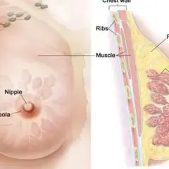 Anatomia piersi: widok zewnętrzny z brodawką i otoczką, oraz przekrój ukazujący tkankę tłuszczową, gruczoły, przewody i wglebienie w piersi.