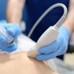 Lekarz w niebieskich rękawiczkach wykonuje biopsję mammotomiczną pod kontrolą USG.