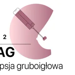 Trzy rodzaje biopsji: cienkoigłowa (BAC), gruboigłowa (BAG) i mammotomiczna (MMT). BIRADS 4a sugeruje biopsję mammotomiczną.