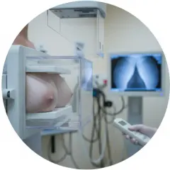 Mammografia w wieku 30 lat to ważny krok w dbaniu o zdrowie. Badanie wykonane w gabinecie diagnostycznym.