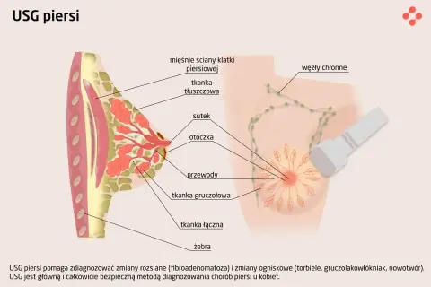 Ilustracja przedstawia budowę piersi i badanie USG. USG piersi w ciąży jest bezpieczne.