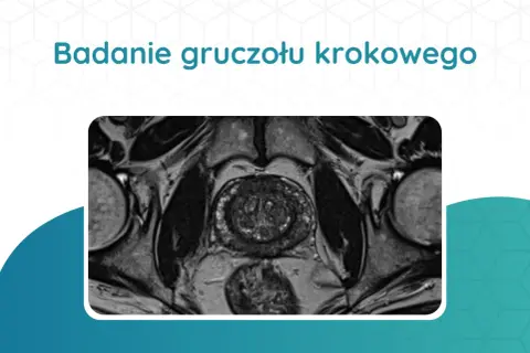 Badanie rezonansem magnetycznym: przekrój gruczołu krokowego, ocena wymiarów prostaty przy raku.
