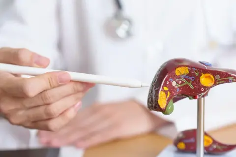Lekarz wskazuje na model wątroby, omawiając chemioterapię na przerzuty do wątroby.