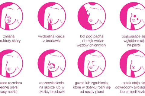 Osiem objawów raka piersi: zmiana struktury skóry, wydzielina z brodawki, ból pod pachą, wgłębienie, asymetria, zaczerwienienie, guzek, odwrócony sutek. Tu mammae dex to znaczy rak piersi.