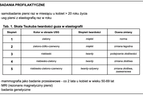Tabela oceny twardości guza w elastografii, kluczowa w diagnostyce raka piersi w Polsce.