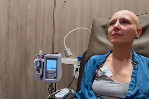 Kobieta po chemioterapii, która może być leczeniem raka jelita grubego. Przyczyny choroby są złożone.
