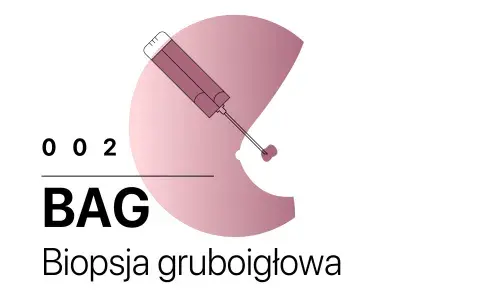 Trzy rodzaje biopsji: cienkoigłowa (BAC), gruboigłowa (BAG) i mammotomiczna (MMT). BIRADS 4a sugeruje biopsję mammotomiczną.