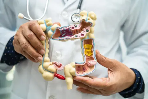 Lekarz pokazuje model jelita grubego, ilustrując możliwości diagnostyczne co zamiast kolonoskopii.