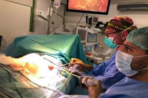 Chirurdzy podczas operacji, która może być przykładem tego, co to jest mastektomia. Na ekranie widać obraz z wnętrza ciała.