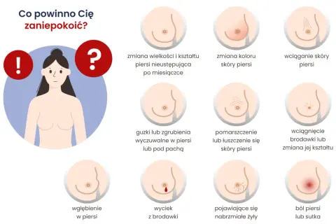 Objawy wskazujące na rozpadający się guz nowotworowy: zmiany w piersiach, guzki, wciągnięcie skóry, wyciek z brodawki, ból.