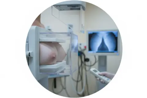 Mammografia w wieku 30 lat to ważny krok w dbaniu o zdrowie. Badanie wykonane w gabinecie diagnostycznym.