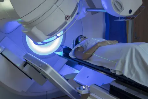 Kobieta leży na stole zabiegowym, przygotowana do radioterapii piersi. Zielone linie lasera wyznaczają pole napromieniania.