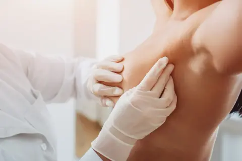 Lekarz w białej rękawiczce delikatnie bada pierś, lokalizując znacznik tytanowy po biopsji.
