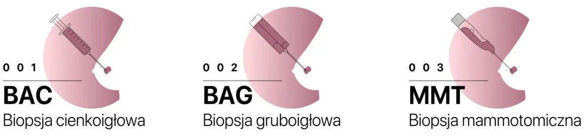 Trzy rodzaje biopsji: cienkoigłowa (BAC), gruboigłowa (BAG) i mammotomiczna (MMT). BIRADS 4a sugeruje biopsję mammotomiczną.