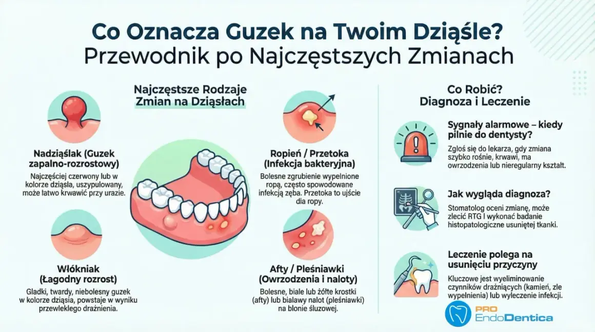 Bezbolesny guzek na dziąśle może być włókniakiem, łagodnym rozrostem. Ilustracja pokazuje różne zmiany na dziąsłach.