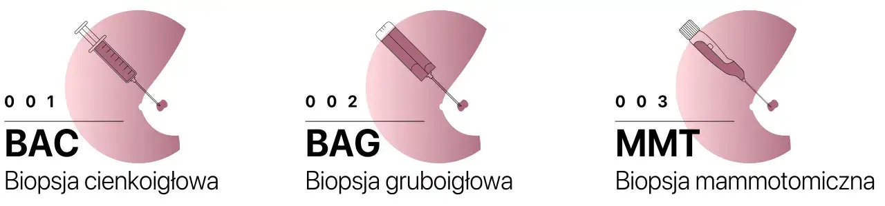 Trzy rodzaje biopsji: cienkoigłowa (BAC), gruboigłowa (BAG) i mammotomiczna (MMT). BIRADS 4a sugeruje biopsję mammotomiczną.