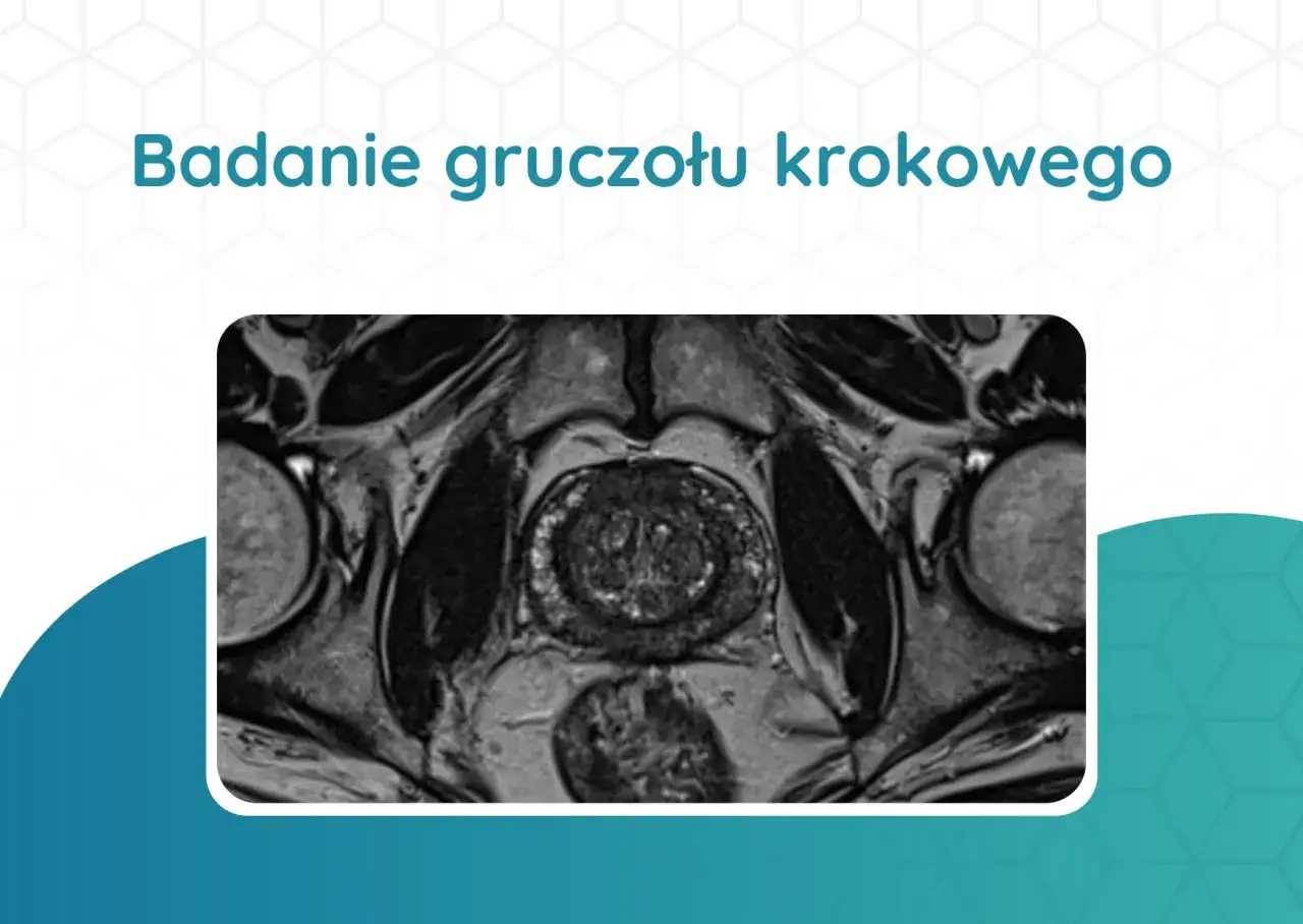 Badanie MRI gruczołu krokowego, uwidaczniające jego przekrój. Obraz może pomóc w ocenie wymiarów prostaty przy raku.