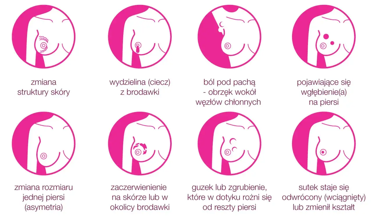 Objawy raka piersi: zmiana struktury skóry, wydzielina z brodawki, ból pod pachą, wgłębienia, asymetria, zaczerwienienie, guzek, odwrócony sutek. W jakim wieku może pojawić się rak piersi?
