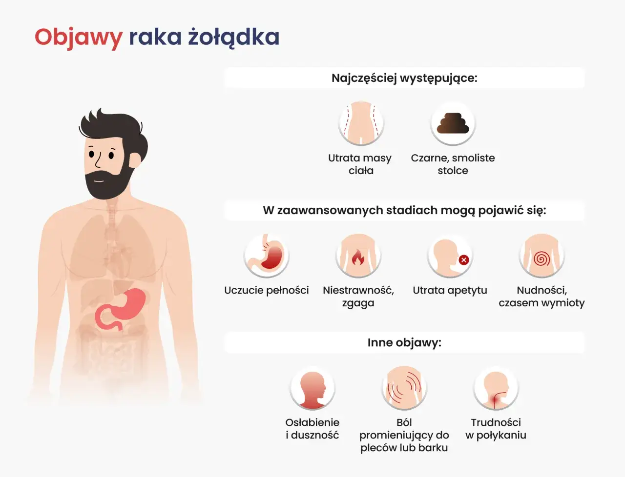 Ilustracja przedstawia objawy raka żołądka, w tym utratę masy ciała i czarne stolce. Wczesne wykrycie raka żołądka w młodym wieku jest kluczowe.