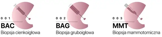 BI-RADS 4A i biopsja mammotomiczna - jak czytać wynik?